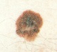 Mole color